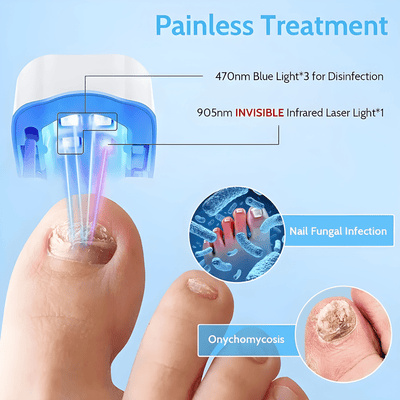 ClearNail Laser - Aureon LabsClearNail Laser